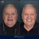Slider image (9) Soho Dental Clinic – All-on-X & Dental Implant Center